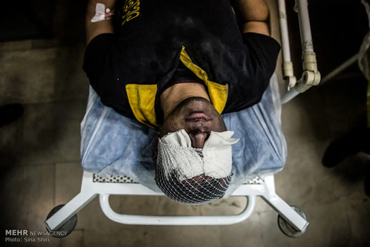 نخستین مصدوم چهارشنبه سوری لرستان در دورود