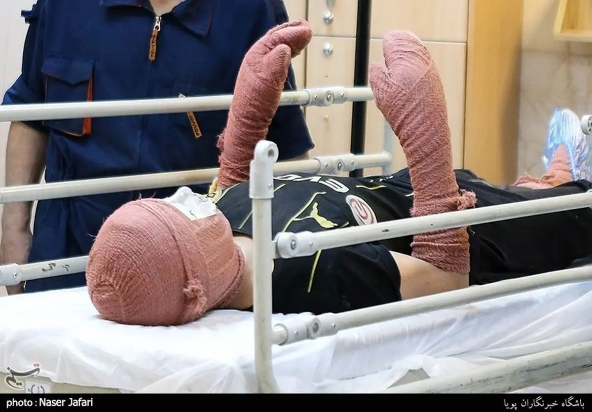 ۲ کشته و ۶۱۵ مصدوم در حوادث چهارشنبه آخر سال تا ساعت ۲۱