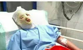 ۲۱ نفر در حوادث چهارشنبه آخر سال گیلان مصدوم شدند