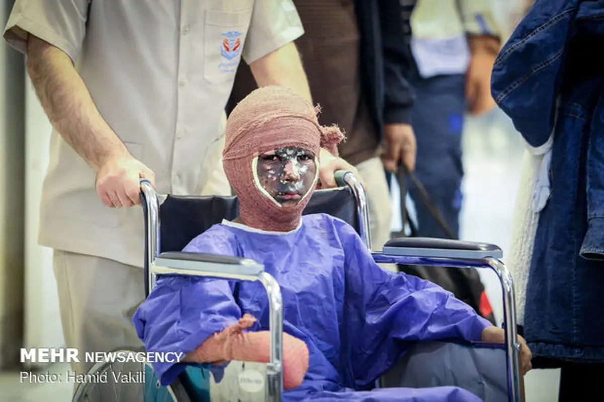 پسر ۱۵ ساله اولین قربانی چهارشنبه سوری خوزستان در اندیمشک