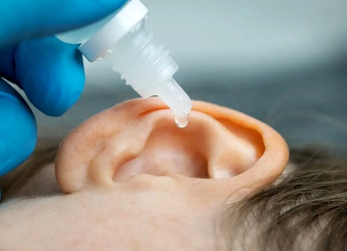 آب رفتن در گوش؛ چه زمانی به پزشک مراجعه کنیم؟