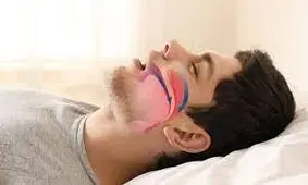 کشف درمان دارویی آپنه انسدادی خواب برای اولین بار در جهان توسط متخصص بیرجندی/ ویدئو
