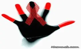 زن ایدزی بعد از 12 سال یک ساعته درمان شد + عکس