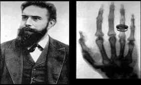 كشف اشعه ايكس توسط "ويلهلم رونتگن" دانشمند معروف آلماني (1896م)