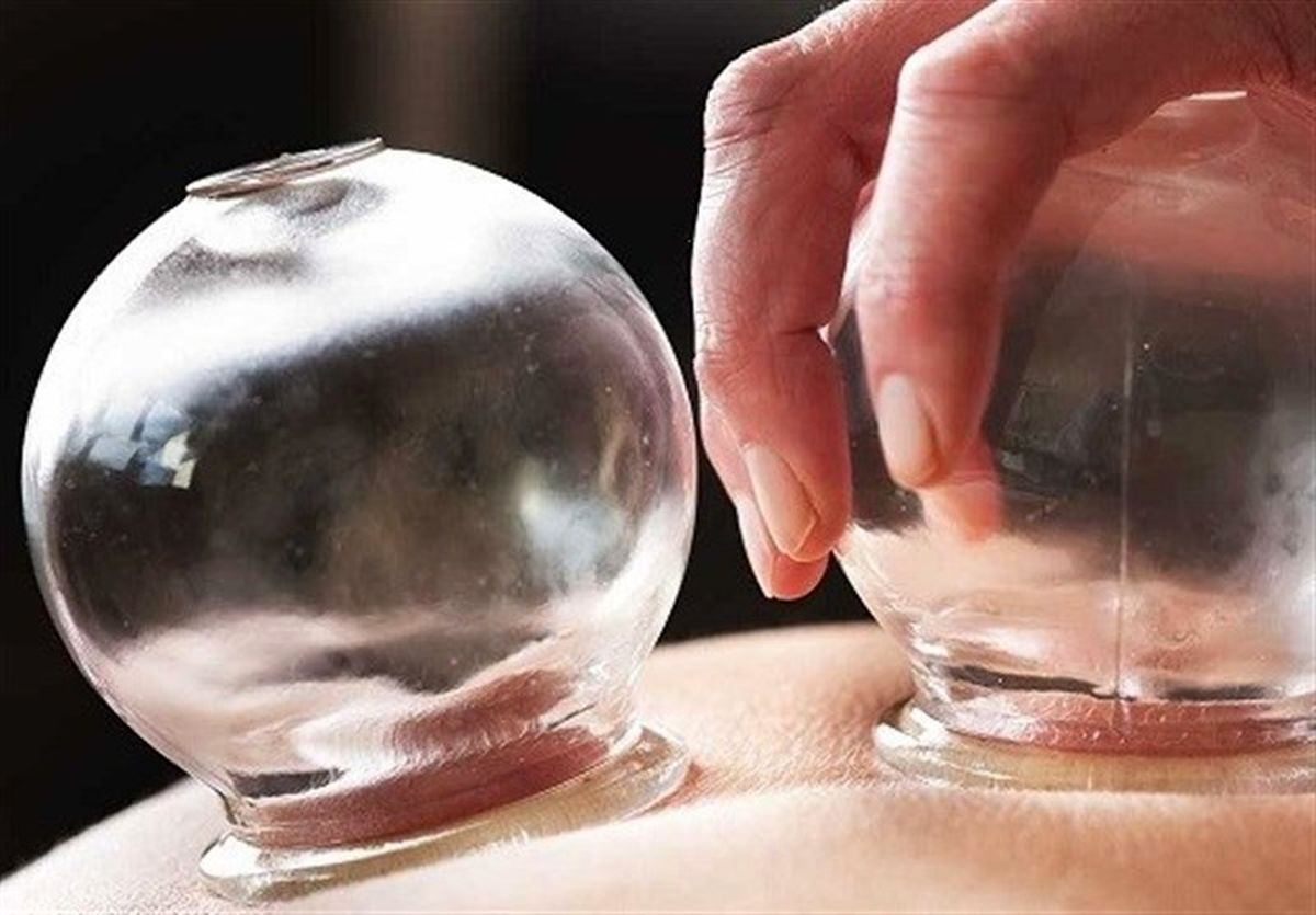 نکاتی که اثر درمانی "حجامت" چند برابر میکند