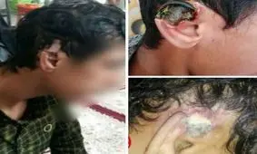 محرومیت مادام العمر عاملان شکستن گوش کشتی‌گیران نوجوان