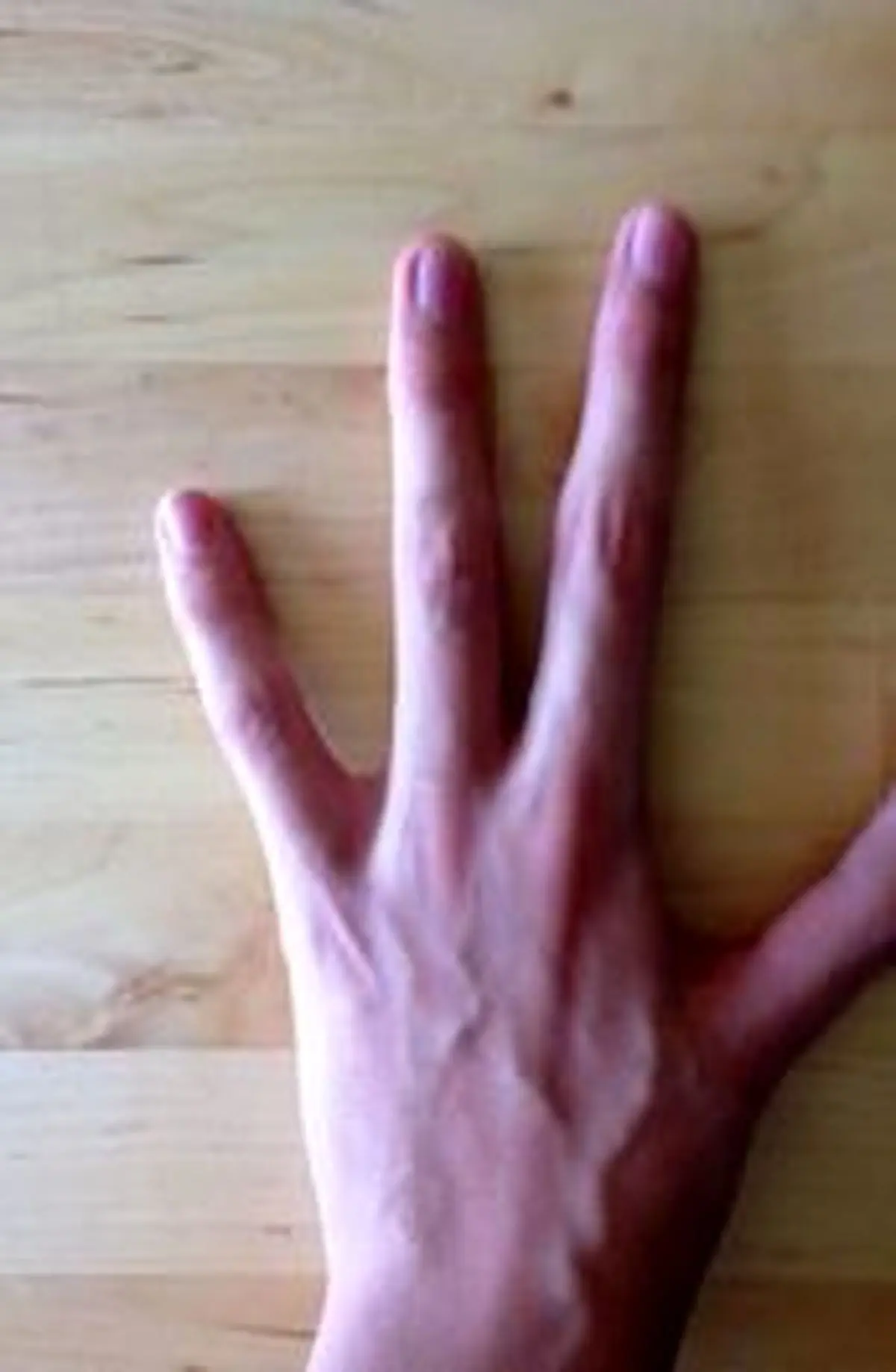 افرادی با ناهنجاری‌های عجیب +تصاویر