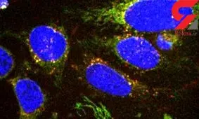 شناخت علائم اولیه سرطان با یک فناوری جدید