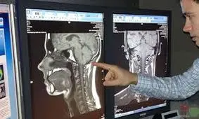 دستگاه تصویربرداری اشعه ایکس برای تشخیص سرطان