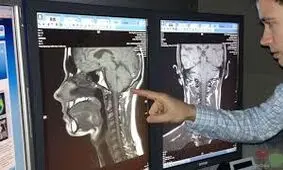 دستگاه تصویربرداری اشعه ایکس برای تشخیص سرطان