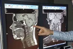 دستگاه تصویربرداری اشعه ایکس برای تشخیص سرطان