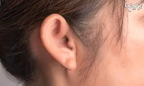 اگر در گوش‌تان آب رفت چطور آن را خارج کنید؟