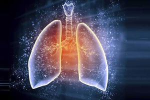 افزایش مبتلایان به انسداد ریه در میان غیرسیگاری‌ها