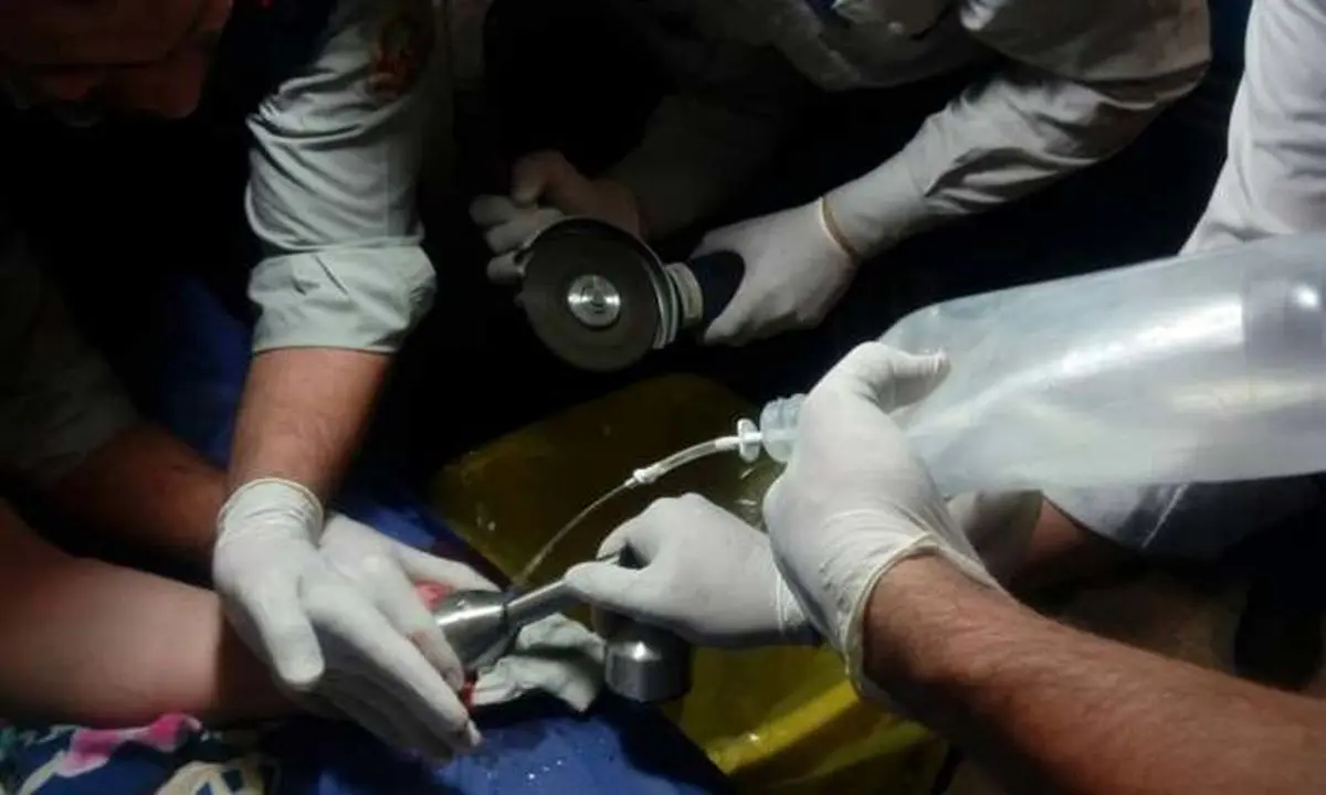 ماجرای عجیب گیر کردن انگشت زن تهرانی در گوشت کوب برقی +تصاویر