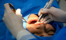 ایرانی‌ها چند میلیون دندان پوسیده دارند؟