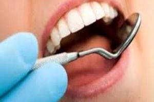 سیستم ایمنی بدن باعث پوسیدگی دندان می‌شود