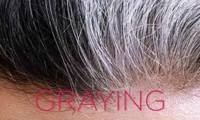 چرا موها سفید می شوند؟ چه باید کرد؟