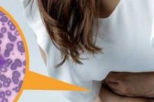 بارداری و عفونت انگلی / علائم عفونت انگلی در بارداری چیست؟