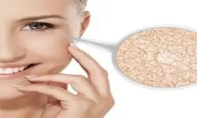 تشخیص سوء‌تغذیه از روی صورت