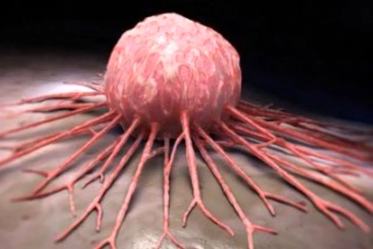 جعبه سیاه تومورهای سرطانی کشف شد