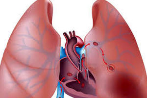 اسیدهای چرب امگا۳ موجب تسریع ایجاد سلول‌های بنیادی قلب می‌شود
