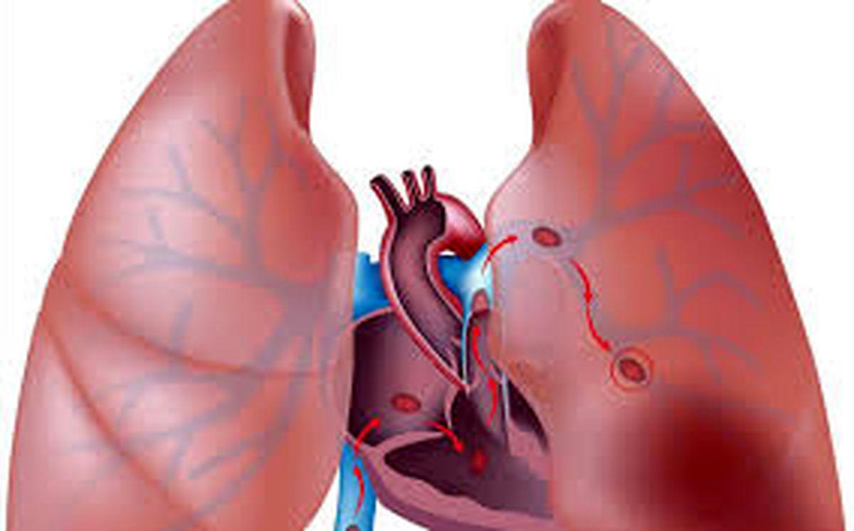 اسیدهای چرب امگا۳ موجب تسریع ایجاد سلول‌های بنیادی قلب می‌شود