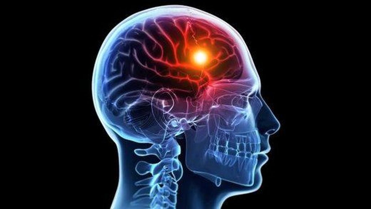 تحریک الکتریکی به تقویت حافظه کمک میکند