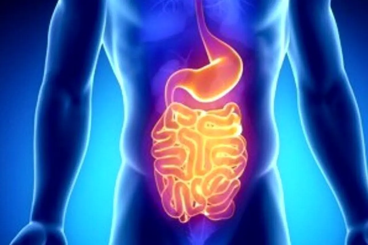 ارائه جدیدترین دستاوردهای علمی بیماری‌های التهابی روده در رشت