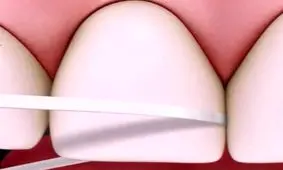 روش صحیح نخ دندان زدن !