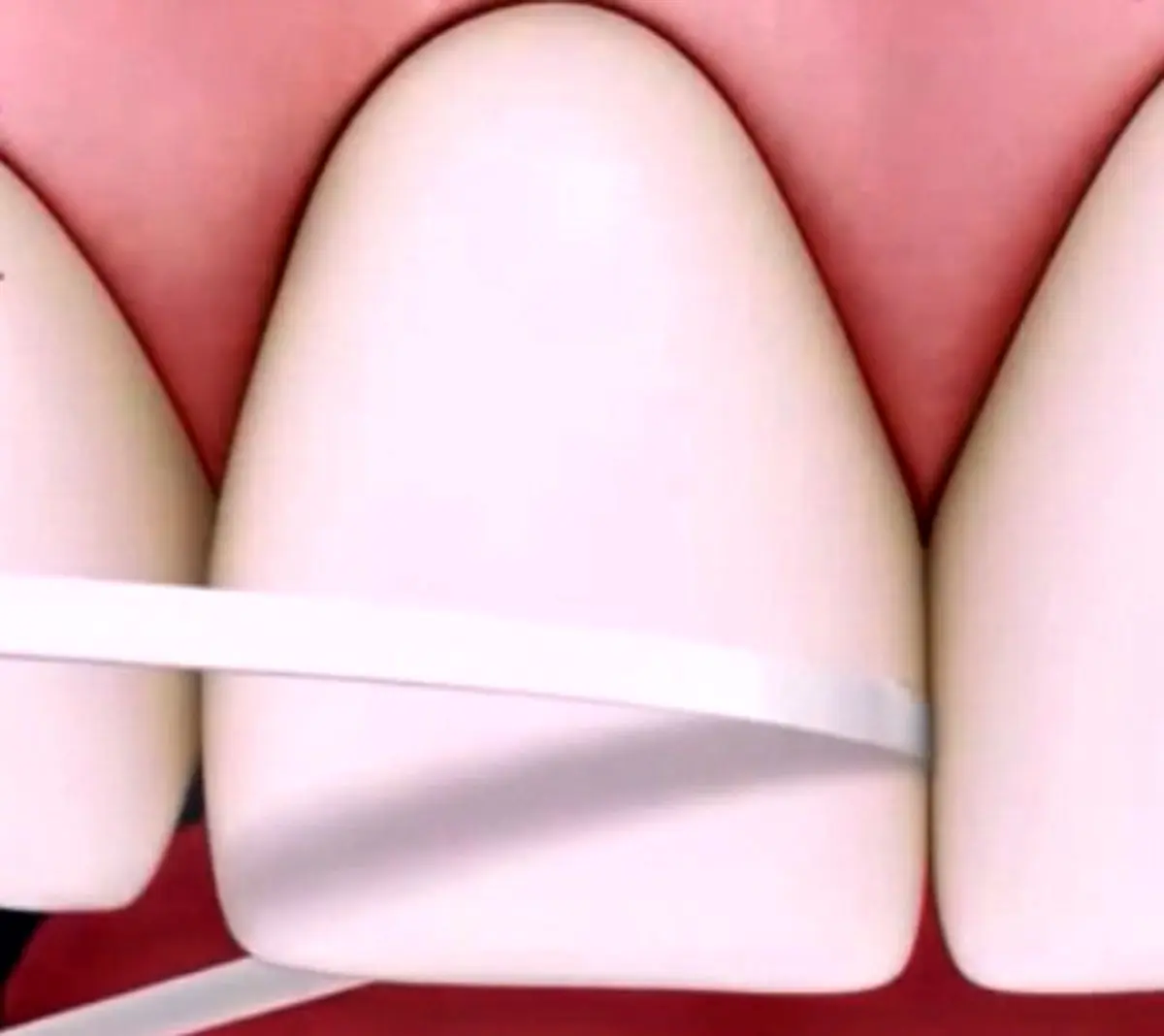 روش صحیح نخ دندان زدن !