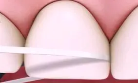 روش صحیح نخ دندان زدن !