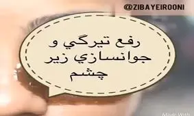رفع تیرگی و جوانسازی دور چشم