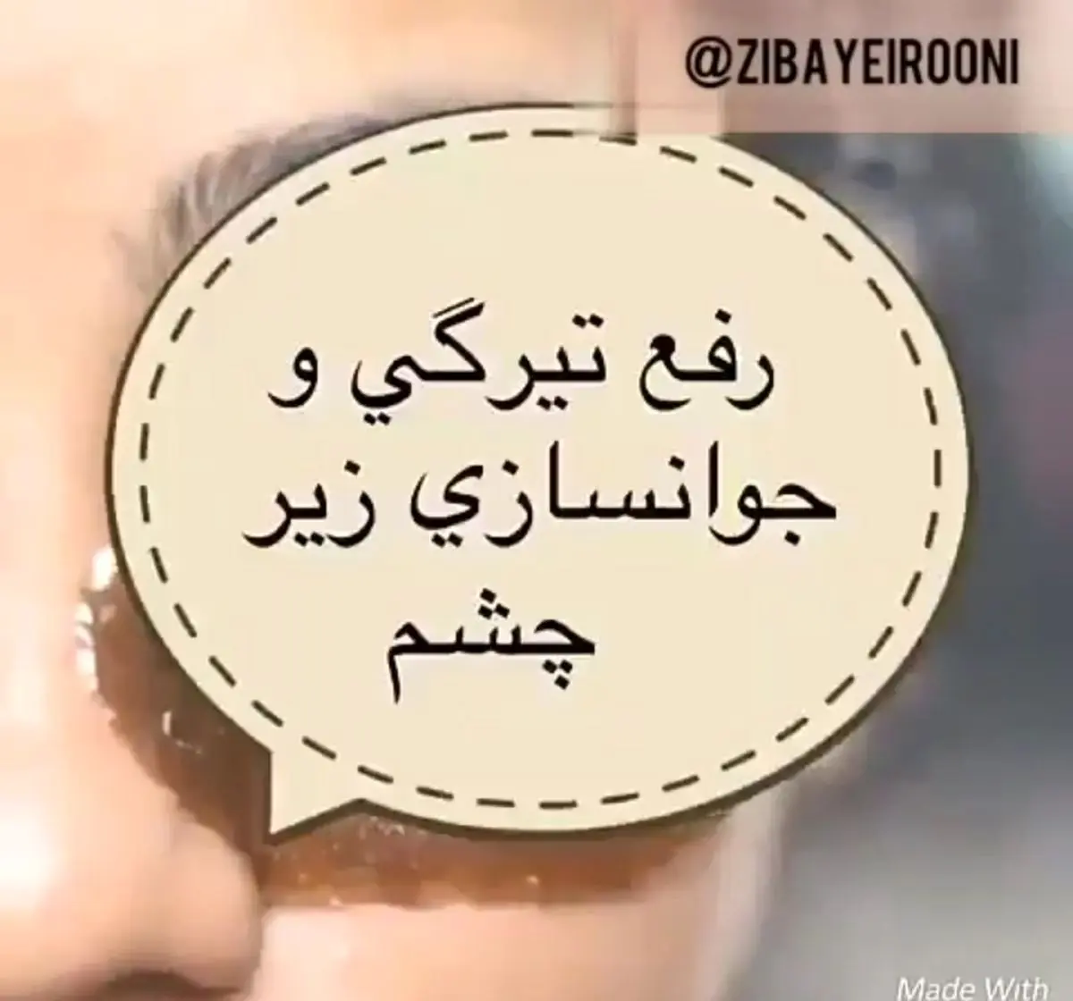 رفع تیرگی و جوانسازی دور چشم