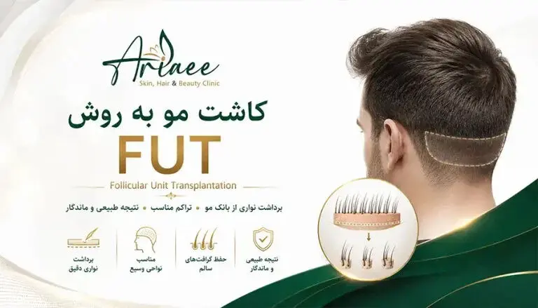 مزایا و محدودیت‌های پیوند مو بدون اصلاح و جراحی
