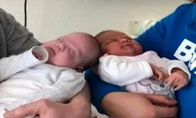 تولد دوقلو های متفاوت با 3 ماه اختلاف سنی ! + عکس