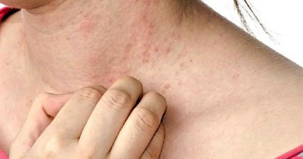 فصل بهار با پوست شما چه می‌کند؟