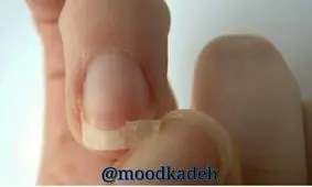 تقویت رشد و استحکام ناخن ها با روغن ارگان