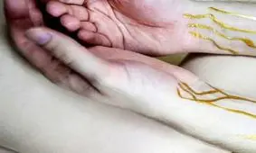 زندگی پرالتهاب مردی که خون طلایی دارد