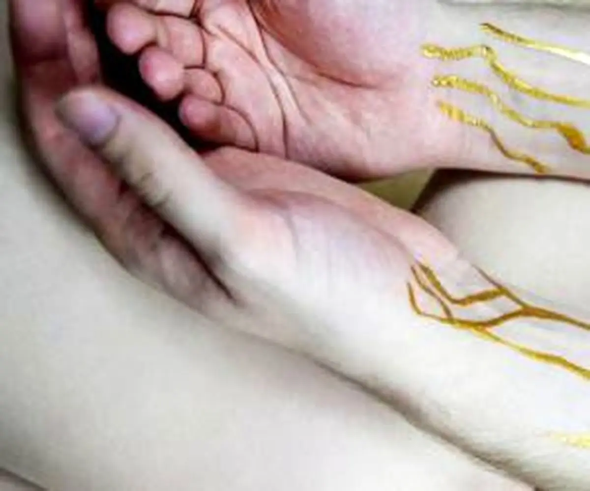 زندگی پرالتهاب مردی که خون طلایی دارد