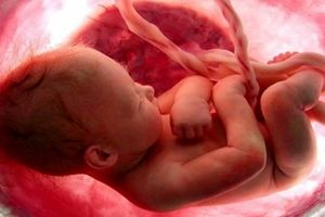 بیماری‌هایی که از طریق سونوگرافی در «جنین » قابل شناسایی است
