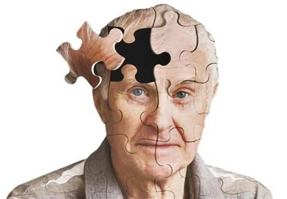 طراحی یک بازی برای تشخیص آلزایمر