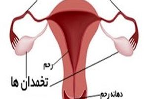 5واقعیت درباره تخمدان ها