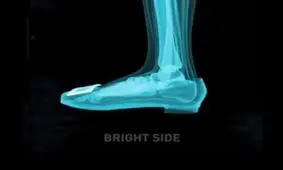 چرا کفش های پاشنه بلند خطرناک هستند؟