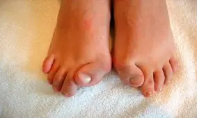 وحشتناک‌ترین بیماری‌های انسان؛ یکی از یکی عجیب‌تر!