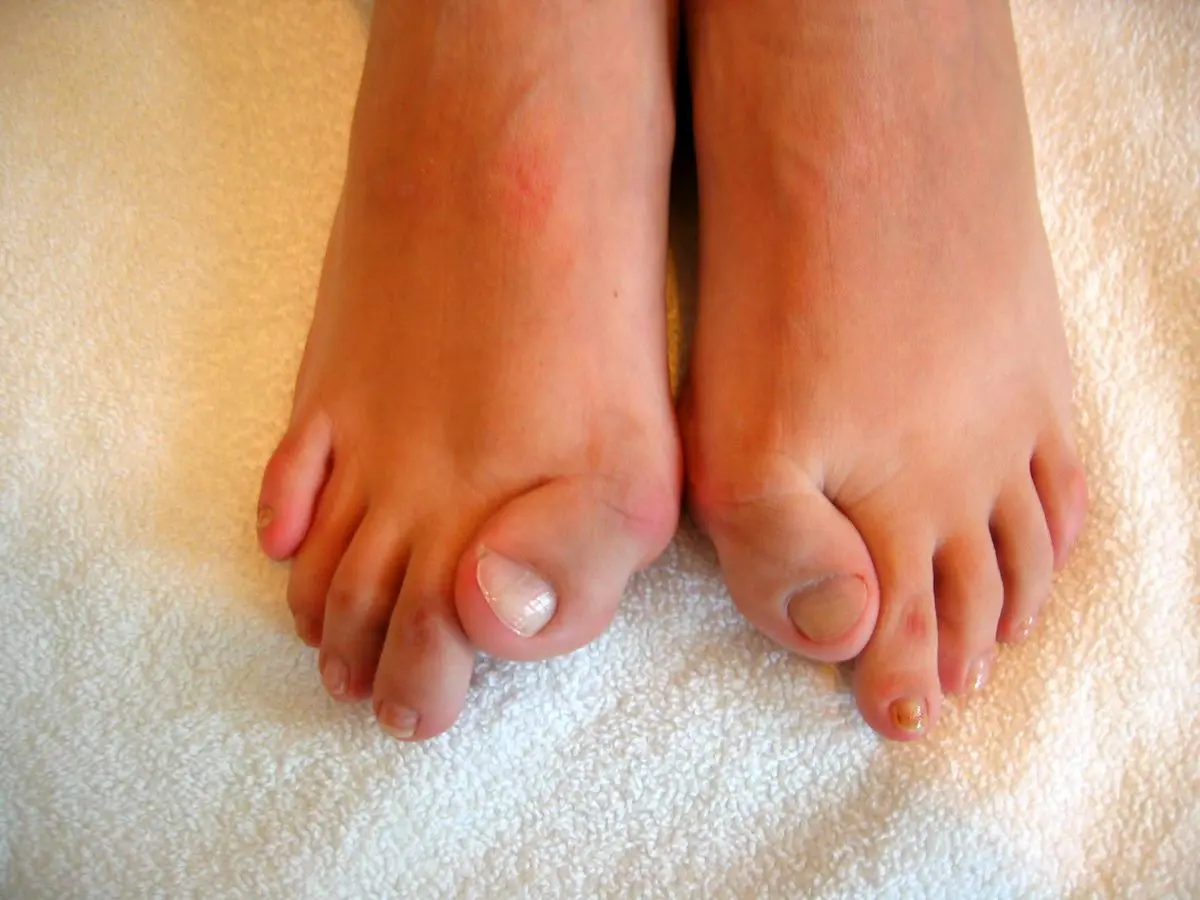 وحشتناک‌ترین بیماری‌های انسان؛ یکی از یکی عجیب‌تر!