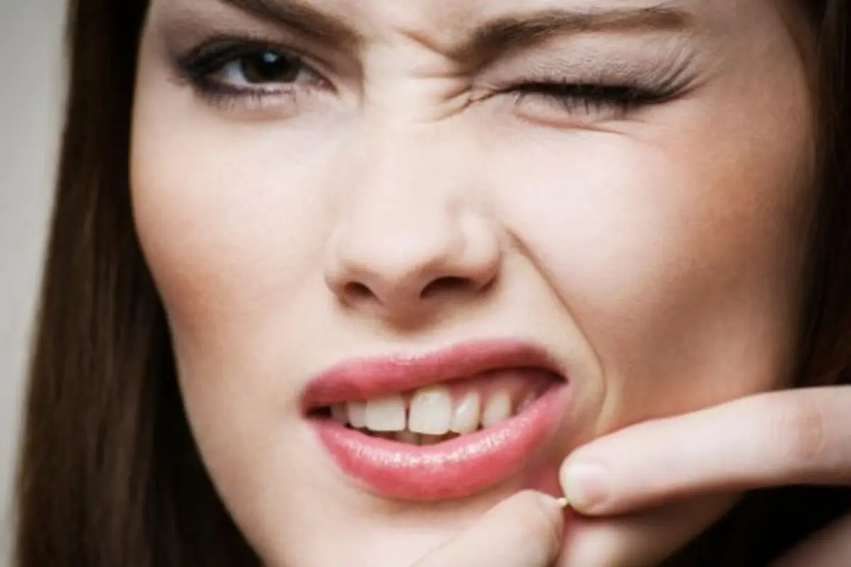 چطور از شر جوش‌های سرسفید خلاص شویم؟