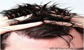 اگر موهایتان زود به زود چرب می‌شود بخوانید
