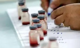 آنچه درباره آزمايش اعتياد نمی‌دانستيد