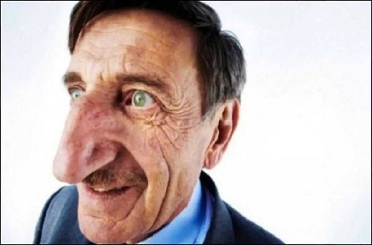 تاثیر افزایش سن روی بینی شما