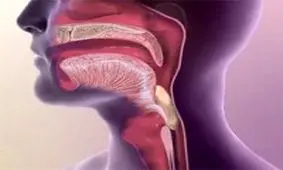 بیماری‌هایی که سبب اختلال بلع می‌شود/ علائم اختلال بلع